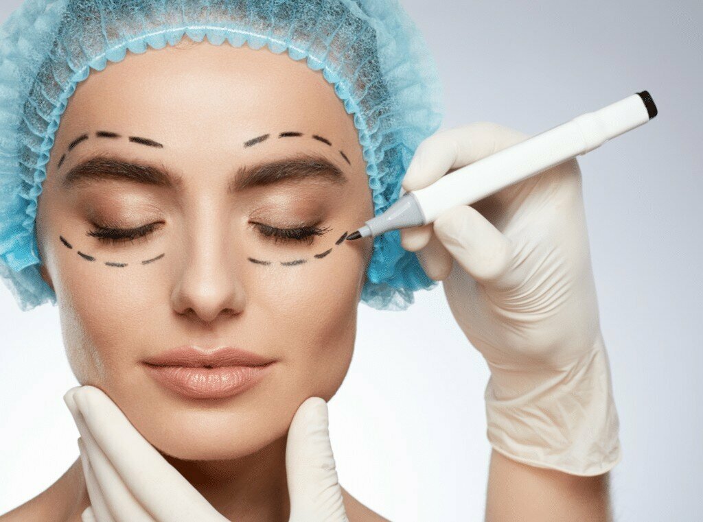 Blepharoplasty Dubai