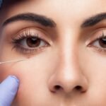 Under-Eye Filler Treatment in Dubai