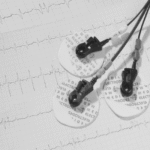 Which Adhesive Gel is Ideal for TENS and EMS Pads?