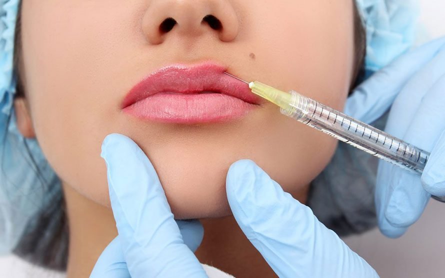Lip Fillers in Dubai