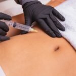 Body Fillers in Dubai