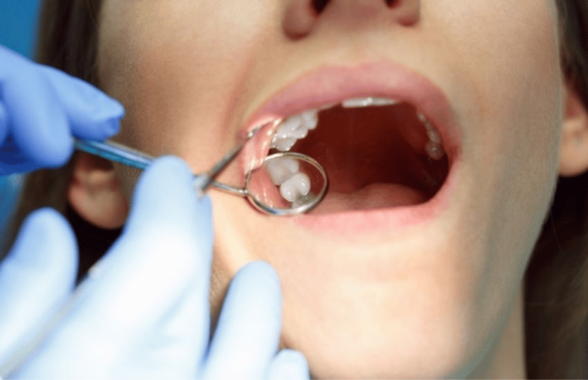 tooth extraction