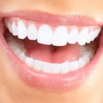 Brighten Your Smile with Professional Teeth Whitening in Tempe