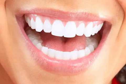 Brighten Your Smile with Professional Teeth Whitening in Tempe