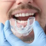 What Makes Invisalign Clear Aligners Different from Traditional Braces?