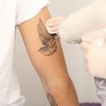 Laser Tattoo removal in Dubai