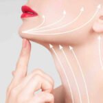 Neck Lift in Dubai