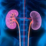 Kidney Disease