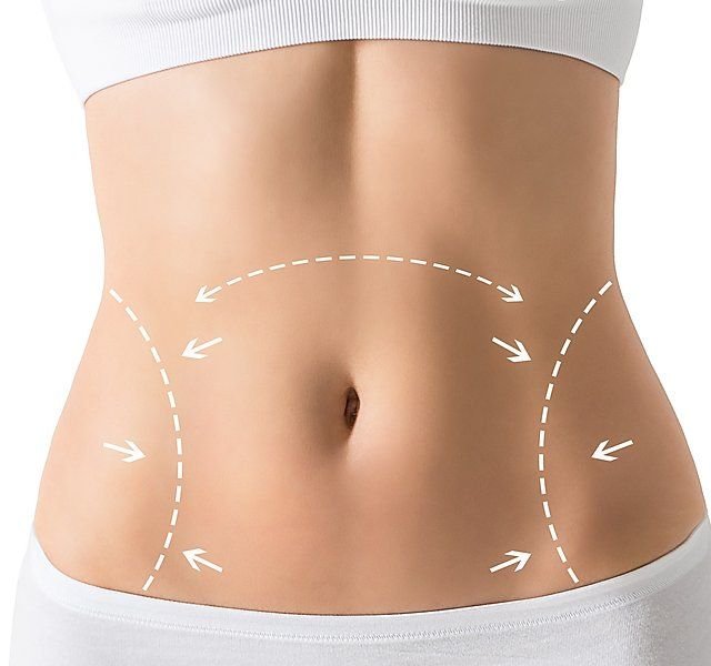 Tummy Tuck in Riyadh