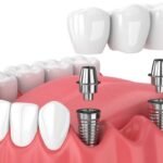 most affordable dentist